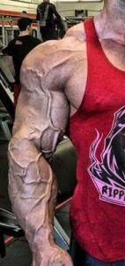 vascular-body-man