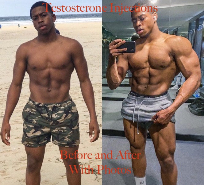 Testosterone-injections-before-and-after-photos-iron-daddy